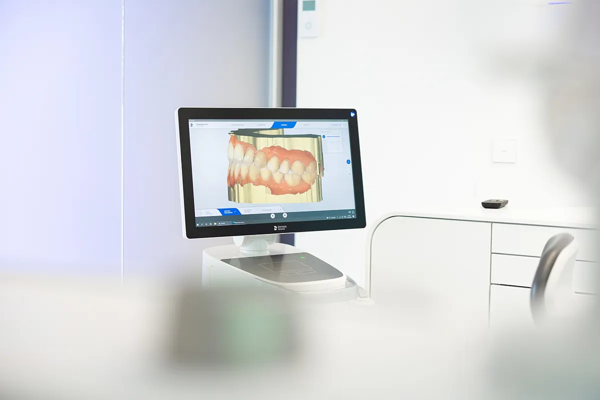Digitaler Intraoralscanner der RKM 740 Zahnmedizin in Düsseldorf zur präzisen 3D-Erfassung der Zahnstruktur